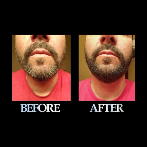 Blackbeard for men dark brown before and after 2