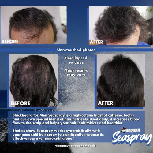 Blackbeard for men Seaspray before and after